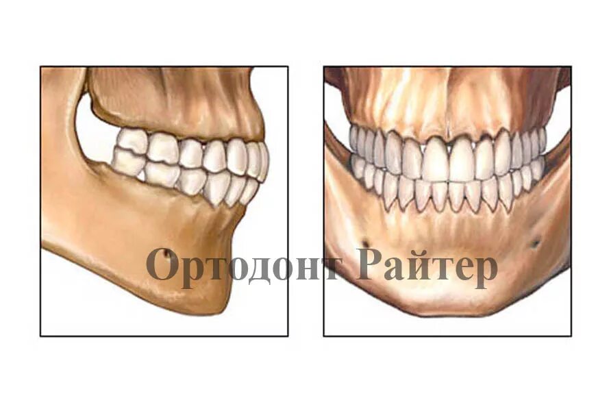 Правильное расположение челюсти сбоку. Челюсть строение прикус. Правильный прикус зубов у человека. Насколько плотно