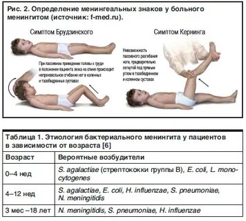 Первые симптомы менингита у взрослых