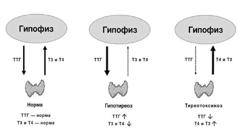 Повышенный т3 при нормальном
