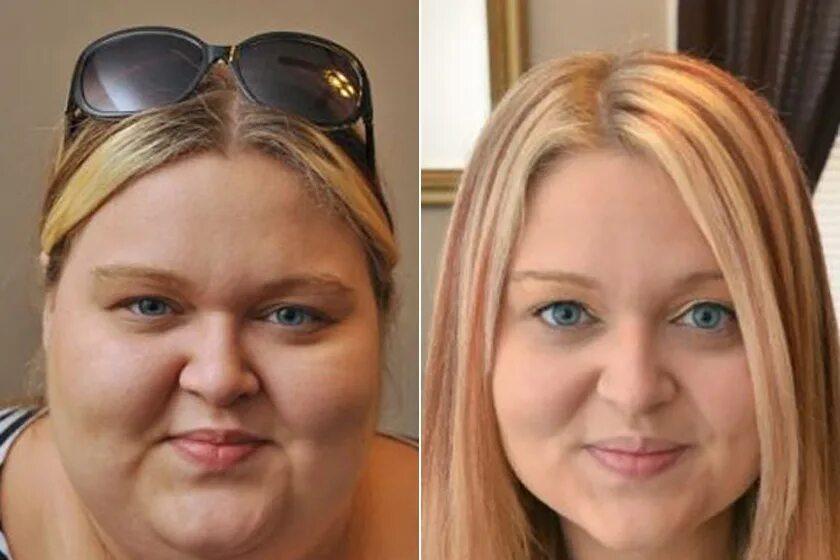 Лицо до и после похудения. Толстое лицо до и после похудения. Лица людей до и после похудения. Девушка со вторым подбородком. Жирнится лоб