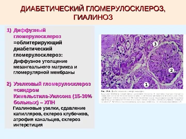 Диффузное утолщение