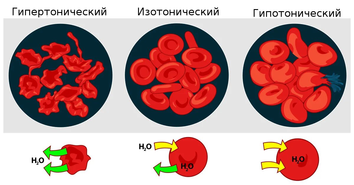Гипертонический и гипотонический раствор. Эритроцит в гипотоническом и гипертоническом растворе. гипотонический изотонический гипертонический раствор эритроциты. эритроциты в изотоническом растворе. эритроциты в гипотоническом растворе.