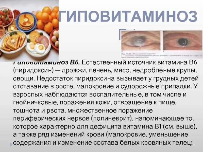 Аллергия на кальций д3 - фото презентация