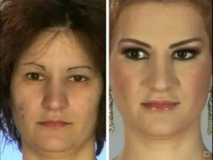 Пластическая операция со скольки лет. Операция по изменению внешности. Результаты пластических операций до и после. Изменилась после пластики лица. До и после пластики лица.