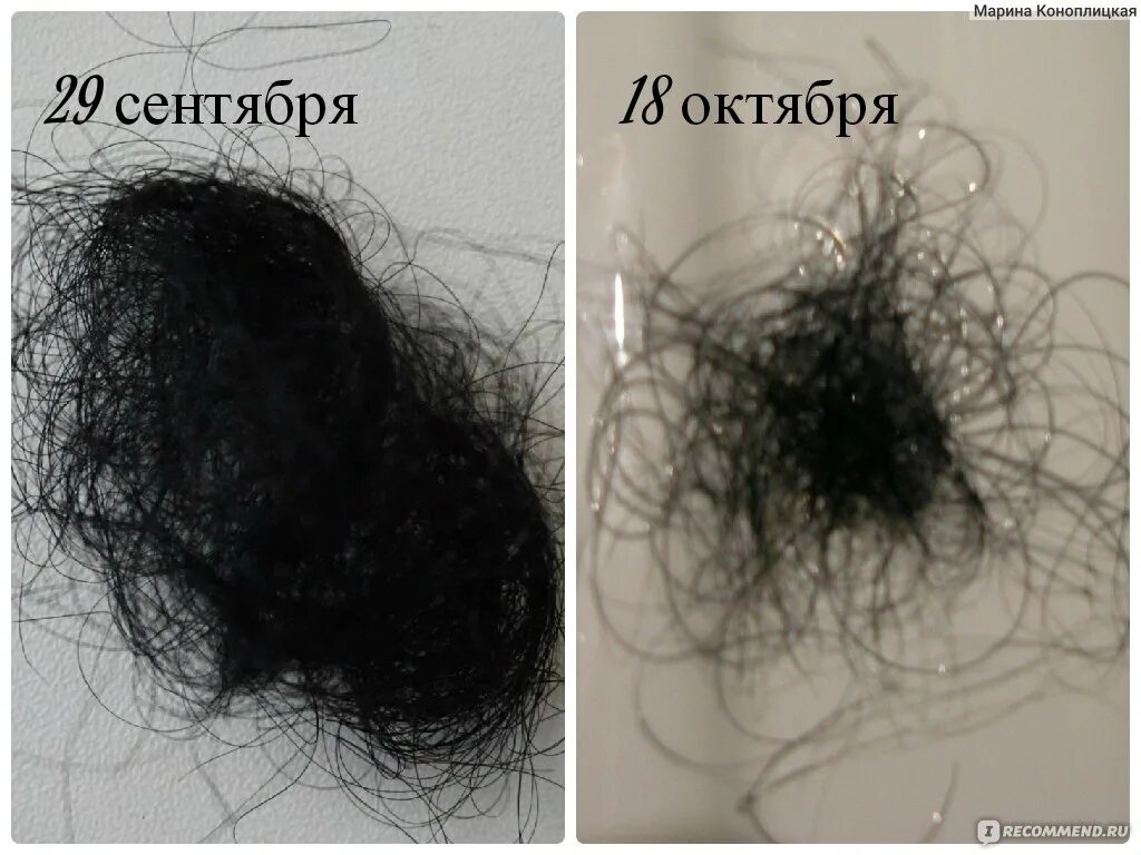 Сколько в норме выпадает