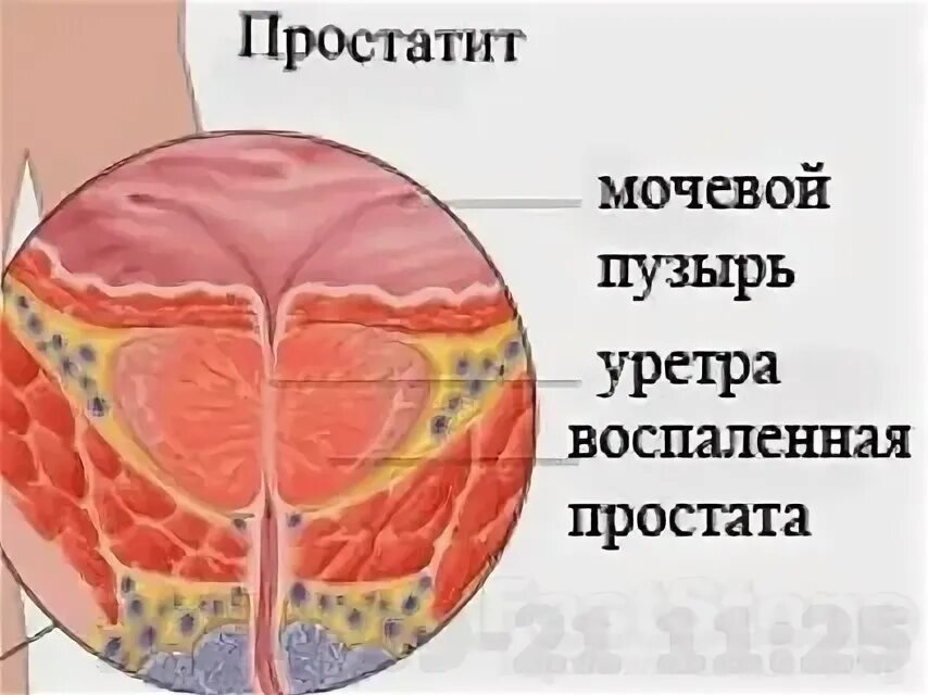 Ним органах что вызывает
