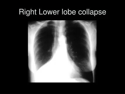 Lower right