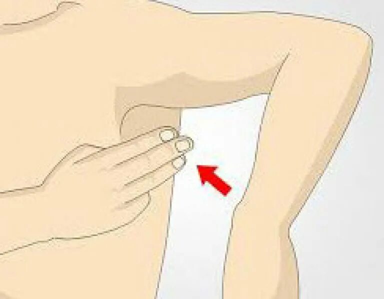 подмышечные лимфоузлы расположение. схема лимфатических узлов под мышкой. воспаление лимфатические узлы грудные железы. подключичные лимфоузлы расположение. лимфоузлы в подмышечной впадине у мужчин.