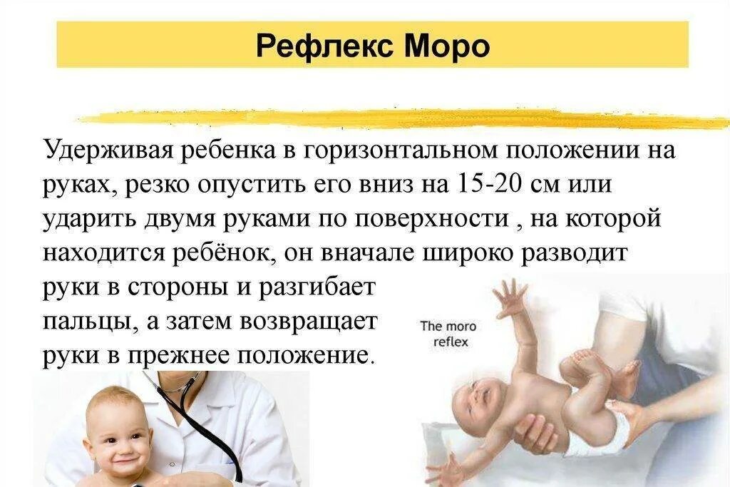 Рефлекс Моро у грудничка в 3 месяца. Эффект Моро у новорожденного. Рефлекс Моро у грудничка в 8 месяцев. Рефлекс Моро у грудничка в 2 месяца.