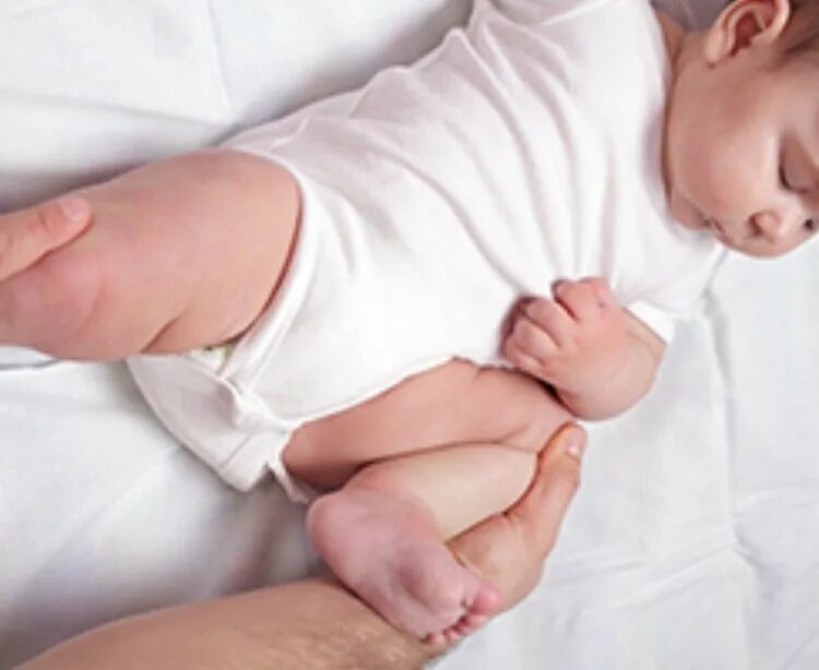 Дисплазия сустава у новорожденного лечение