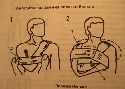 Повязка вельпо