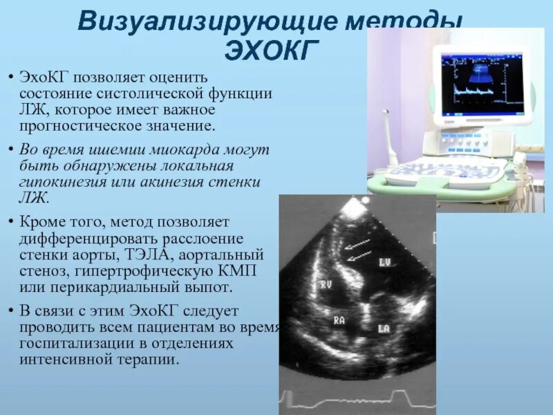 Гипокинез передних сегментов. Гипокинезия миокарда эхокг. зоны акинезии на эхокг. что позволяет оценить эхокг. зоны гипокинеза эхокг.