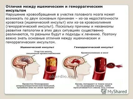 Восстановление мозгового кровообращения