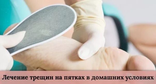 Вылечить трещину в домашних условиях