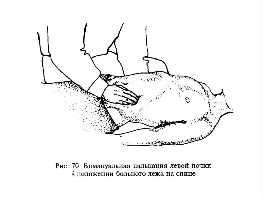 Пальпация живота. Бимануальная пальпация почек. Пальпация тонкого кишечника. Пальпация прямой кишки. Пальпация толстой кишки.