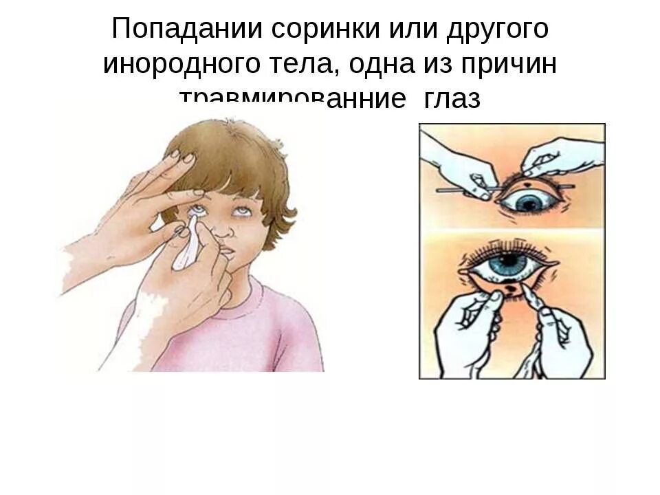 Ощущение что глазам что то мешает. Что делать если попало в глаз. Попала Ворсинка в нлаз. Что делать если чтото попала в Глез.