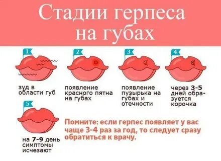 Причины появления герпеса