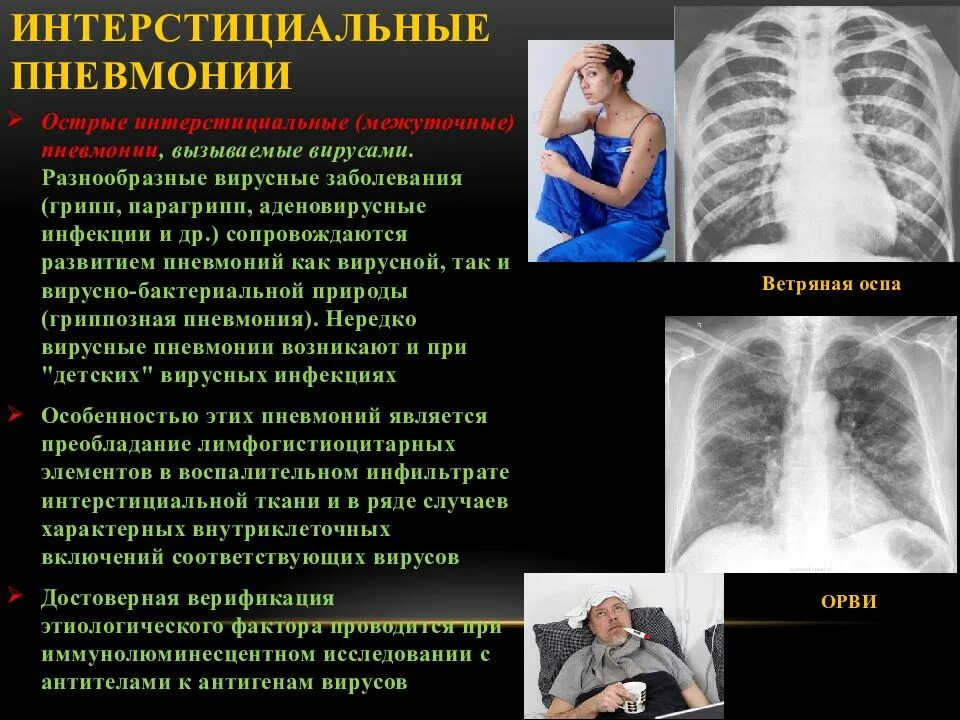 Заразные заболевания легких. Межуточная пневмония проявление.