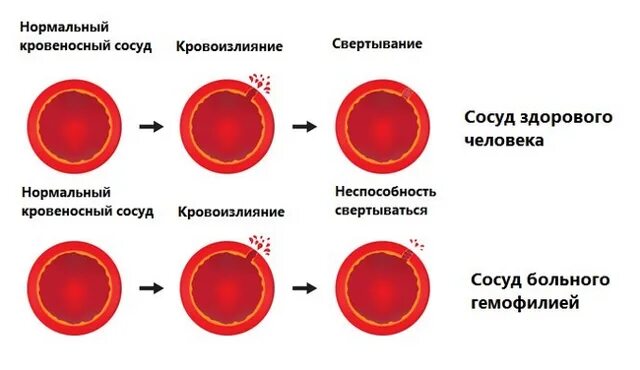 Почему кровь сворачивается при анализе