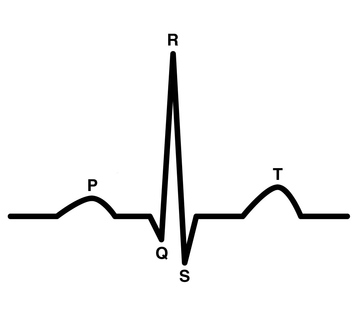 Нарастание зубца. Синдром укорочения интервала PQ на ЭКГ. Комплекс QRS на ЭКГ. P QRS T ЭКГ. Комплекс PQRST на ЭКГ.