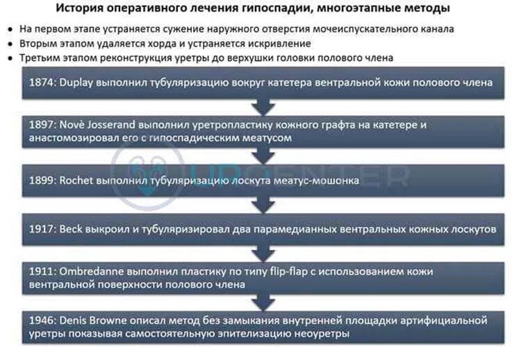 Гипоспадия у взрослых. Методы оперативного лечения гипоспадии. гипоспадия венечной формы у ребенка. гипоспадия принципы хирургического лечения.