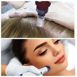 Фракционная мезотерапия для лица