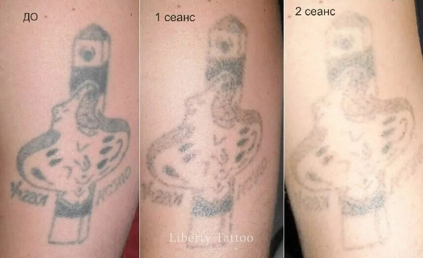Можно ли тату. Алкоголь после татуировки. татуировка после 1 сеанса.