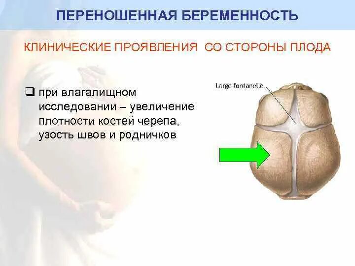 Исследование родничков черепа у ребенка. Плотные швы черепа у ребенка. Кости черепа плода плотные швы ￼.