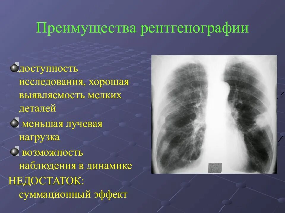 Болезнь легкий диагностика. Рентгенодиагностика заболеваний легких. Лучевая диагностика легких. Болезни легких на рентгене. Лучевая диагностика заболеваний легких.