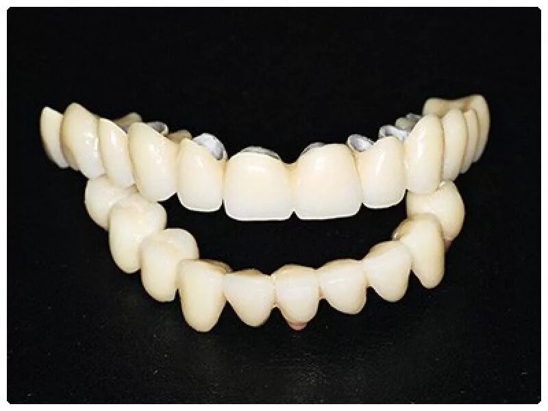 Сколько стоит металлические зубы. Металлопластмассовый мостовидный протез. Металлоакриловый мостовидный протез. Зубные протезы металлокерамика. Подкова металлокерамика.