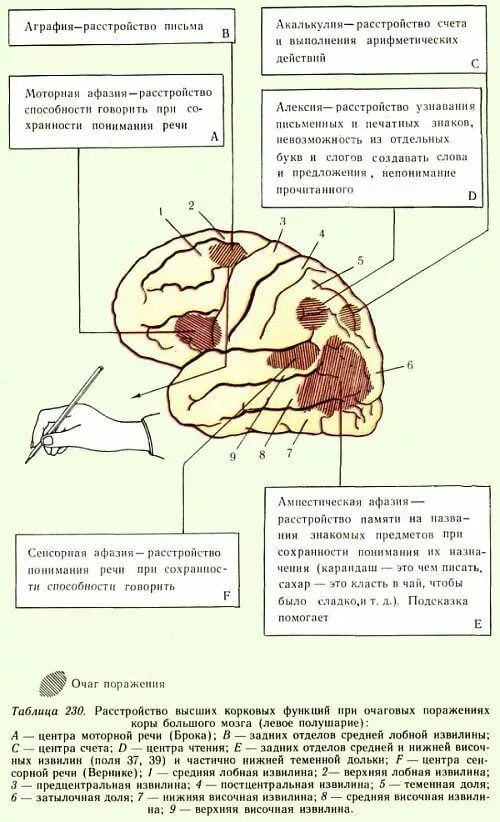 Структура очагов поражения. Афазии схема мозга. Расстройства речи при поражении коры большого мозга (афазии).. Очаги поражения при афазии. Карта мозга с речевыми зонами при афазии.