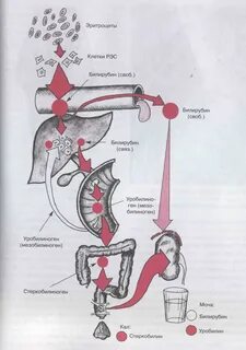 Гемолитический билирубин