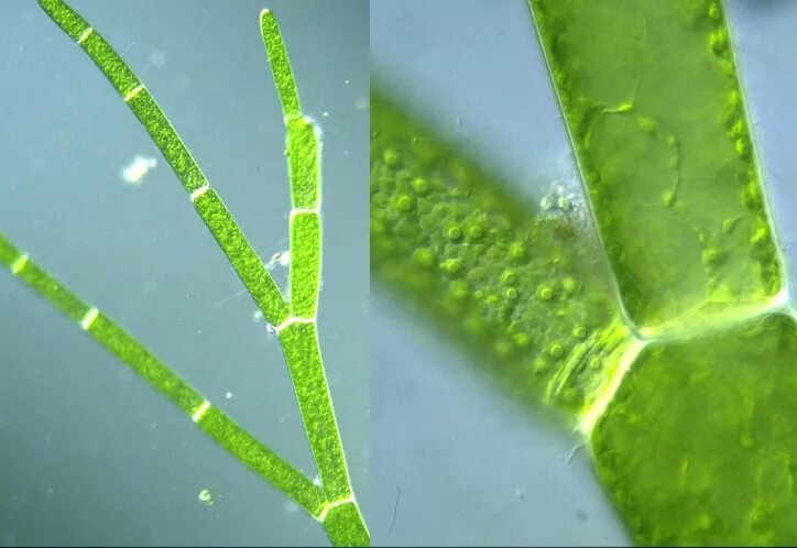 Кладофора водоросль. Кладофора водоросль микроскоп. Кладофора нитчатая. Кладофора клетка.