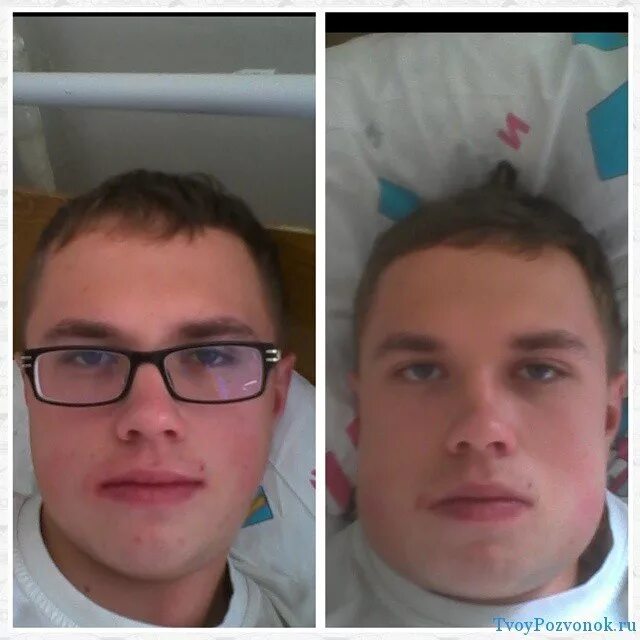 отеки лица при шейном остеохондрозе. шейный остеохондроз. отек лица при остеохондрозе шейного. заболевания глаз при остеохондрозе. отеки лица при шейном остеохондрозе.