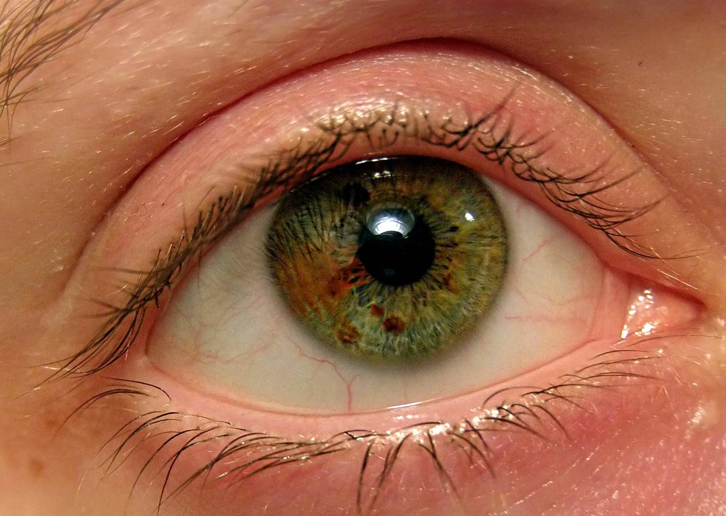 Почему глаза желтые причина. Центральная гетерохромия глаз. Гетерохромия Радужки глаз. Цвет глаз гетерохромия Центральная. Центральная гетерохромия глаз Карий и зеленый.