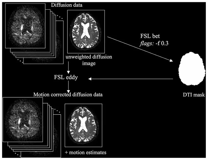 Diffusion tensor. Diffusion tensor imaging (dti). diffusion eatrixtion mri. dti mri. stable diffusion нейросеть.