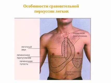 Перкуссия и аускультация