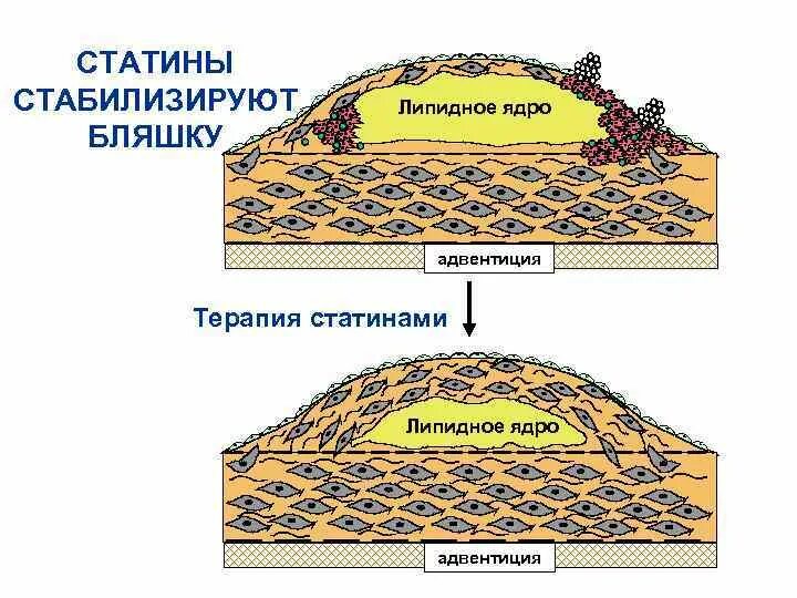 Как уменьшить бляшку