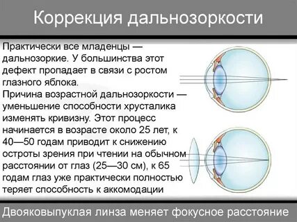 Какие линзы в очках