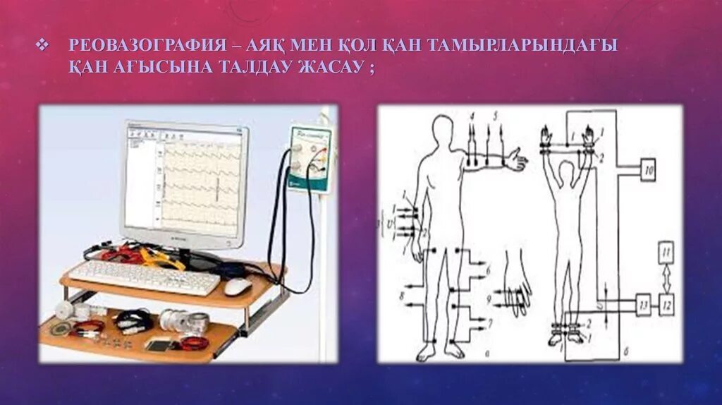 Реовазографии конечностей. Реовазографии конечностей