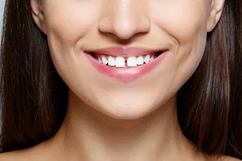 Bare teeth
