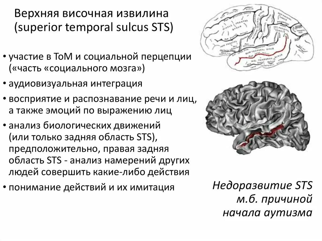 Извилина Гешля. Верхняя височная извилина. Височная функция мозга