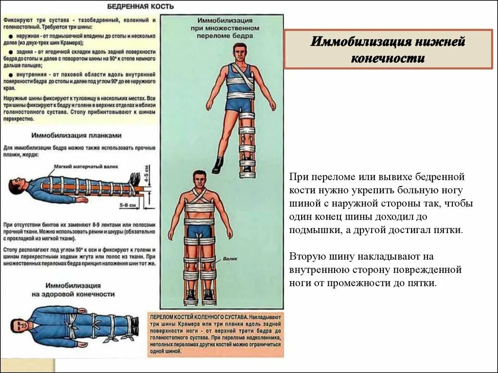 При открытом переломе перед наложением шины. Иммобилизация конечности при переломе бедренной кости. Иммобилизация конечности при переломе бедра. Тммобтлизацич припереломе бедренноц Аости. Иммобилизация при переломе бедренной кости.