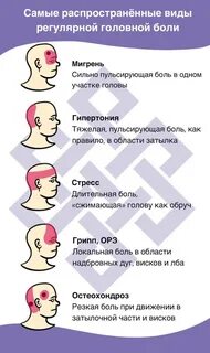 Боль в голове с одной стороны
