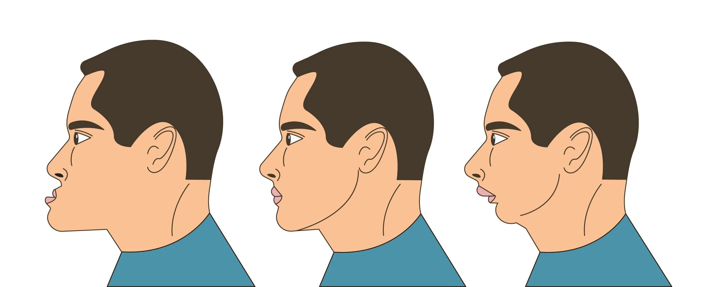 Подбородок выдвинут вперед. Выдвинутая нижняя челюсть. Подбородок назад. Челюсть выдвинута вперед. Один подбородок только выступал очень далеко вперед