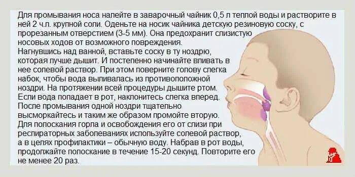 Сон доставать из носа. Слизь в носоглотке у ребенка. слизь в носоглотке причины. заложен нос и слизь в носоглотке. у ребенка слизис из носа.