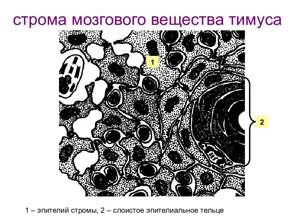 Тип стромы в
