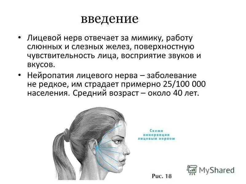 Неврит лицевого нерва схема. Схема лечения лицевого неврита. неврит левого лицевого нерва. неврит лицевого нерва остаточные явления.