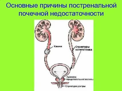 Постренальная почечная