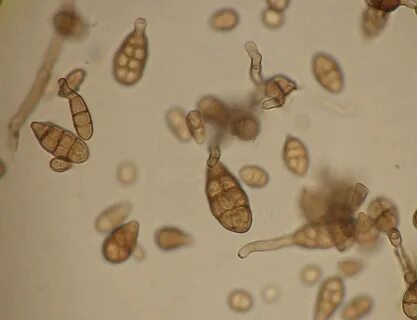Alternaria alternata что это